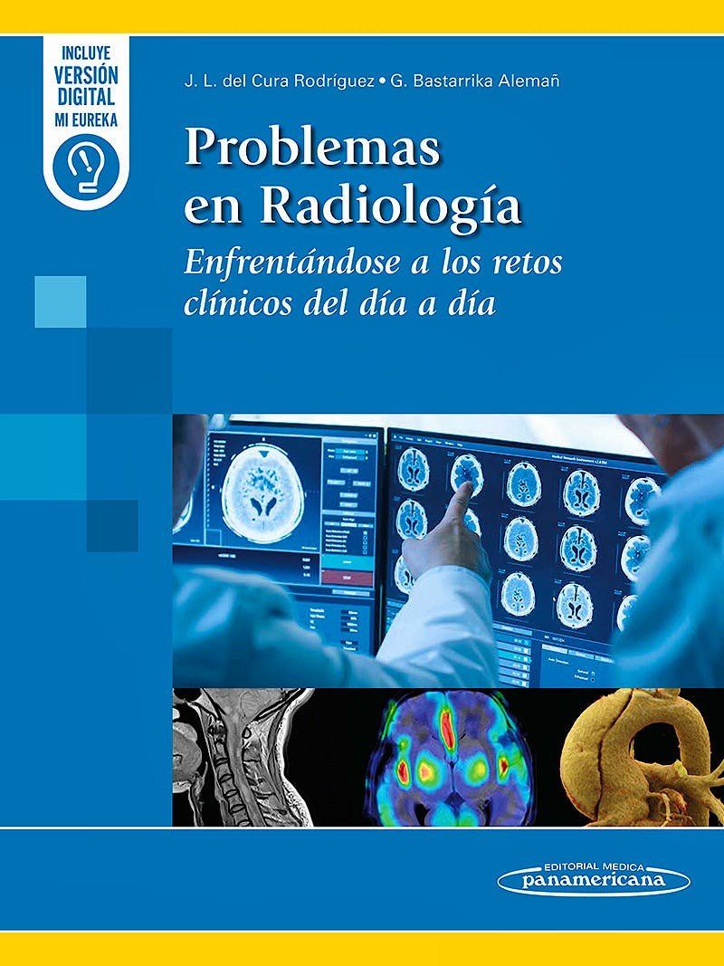 RadiologiaProb