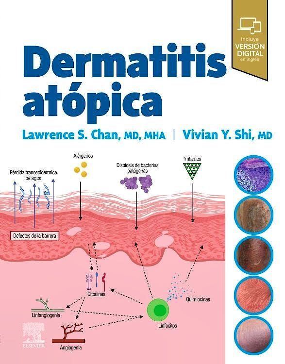 Dermatitis